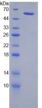 NRP2 / Neuropilin 2 Protein - Recombinant Neuropilin 2 By SDS-PAGE