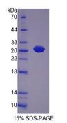 NT5M Protein - Recombinant 5'-Nucleotidase, Mitochondrial (NT5M) by SDS-PAGE
