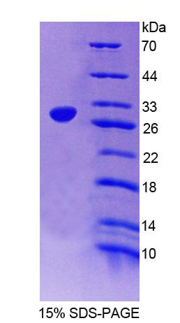 NXF1 / TAP Protein - Recombinant Nuclear RNA Export Factor 1 By SDS-PAGE