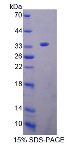 OIT3 Protein - Recombinant  Oncoprotein Induced Transcript 3 By SDS-PAGE