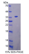OIT3 Protein - Recombinant  Oncoprotein Induced Transcript 3 By SDS-PAGE