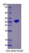 OPHN1 Protein - Recombinant Oligophrenin 1 (OPHN1) by SDS-PAGE