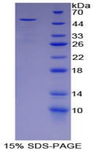 ORM1 / Orosomucoid Protein - Recombinant Alpha-1-Acid Glycoprotein By SDS-PAGE
