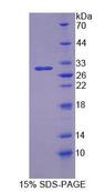 OS9 Protein - Recombinant Osteosarcoma Amplified 9 (OS9) by SDS-PAGE