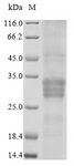 OSM / Oncostatin M Protein - (Tris-Glycine gel) Discontinuous SDS-PAGE (reduced) with 5% enrichment gel and 15% separation gel.