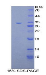 OSMR / IL-31R-Beta Protein - Recombinant Oncostatin M Receptor By SDS-PAGE