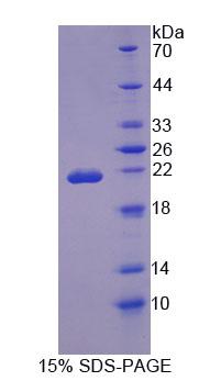 OSTM1 Protein - Recombinant Osteopetrosis Associated Transmembrane Protein 1 (OSTM1) by SDS-PAGE