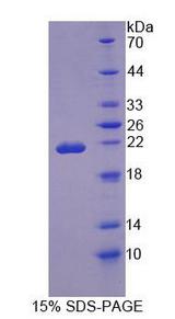 OSTM1 Protein - Recombinant Osteopetrosis Associated Transmembrane Protein 1 (OSTM1) by SDS-PAGE