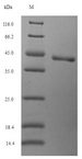 OSTN / Musclin / Osteocrin Protein - (Tris-Glycine gel) Discontinuous SDS-PAGE (reduced) with 5% enrichment gel and 15% separation gel.