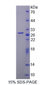 PAG1 Protein - Recombinant  Phosphoprotein Associated With Glycosphingolipid Microdomains 1 By SDS-PAGE