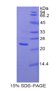 PANX1 / Pannexin 1 Protein - Recombinant Pannexin 1 By SDS-PAGE