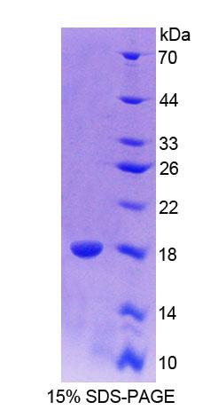 PAX6 Protein - Recombinant  Paired Box Gene 6 By SDS-PAGE