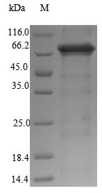 PCSK2 Protein - (Tris-Glycine gel) Discontinuous SDS-PAGE (reduced) with 5% enrichment gel and 15% separation gel.