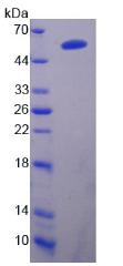 PCSK9 Protein - Recombinant  Proprotein Convertase Subtilisin/Kexin Type 9 By SDS-PAGE