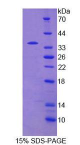 PDE4B Protein - Recombinant  Phosphodiesterase 4B, cAMP Specific By SDS-PAGE
