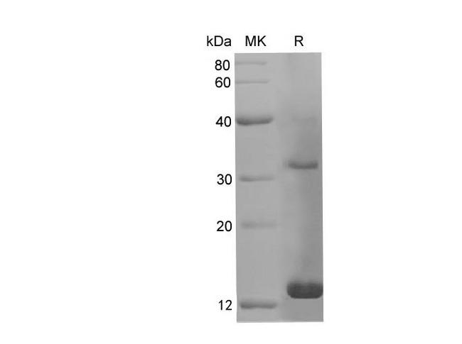 PDGF-BB Protein - Recombinant Rat PDGF-B Protein (His Tag)-Elabscience