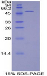PECAM-1 / CD31 Protein - Recombinant Platelet/Endothelial Cell Adhesion Molecule By SDS-PAGE
