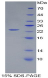 PGLYRP1 / PGRP Protein - Recombinant Peptidoglycan Recognition Protein 1 By SDS-PAGE