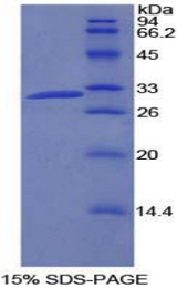 PIK3C2B Protein - Recombinant Phosphoinositide-3-Kinase Class-2-Beta Polypeptide By SDS-PAGE