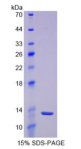 PIP / GCDFP-15 Protein - Recombinant Prolactin\xa0Induced\xa0Protein\xa0(PIP) By SDS-PAGE