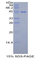 PIP / GCDFP-15 Protein - Recombinant Prolactin Induced Protein By SDS-PAGE
