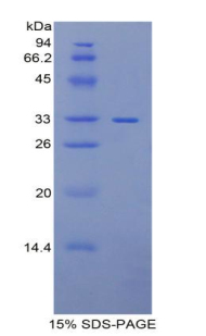 PITRM1 / MP1 Protein - Recombinant Pitrilysin Metalloproteinase 1 By SDS-PAGE