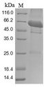PKM / Pyruvate Kinase, Muscle Protein - (Tris-Glycine gel) Discontinuous SDS-PAGE (reduced) with 5% enrichment gel and 15% separation gel.