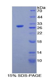 PLA2G6 / IPLA2 Protein - Recombinant Phospholipase A2, Calcium Independent By SDS-PAGE