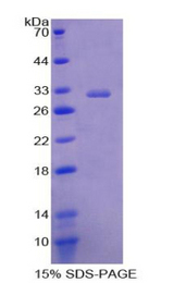 PLAP / Alkaline Phosphatase Protein - Recombinant Alkaline Phosphatase, Placental By SDS-PAGE