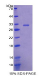 PLAP / Alkaline Phosphatase Protein - Recombinant Alkaline Phosphatase, Placental By SDS-PAGE