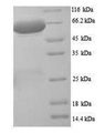 PLBD2 Protein - (Tris-Glycine gel) Discontinuous SDS-PAGE (reduced) with 5% enrichment gel and 15% separation gel.