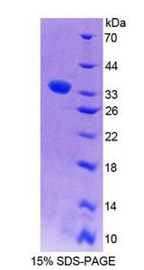 PLCE1 Protein - Recombinant Phospholipase C Epsilon 1 (PLCe1) by SDS-PAGE