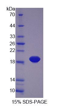 PLTP Protein - Recombinant Phospholipid Transfer Protein (PLTP) by SDS-PAGE