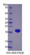 PLTP Protein - Recombinant Phospholipid Transfer Protein (PLTP) by SDS-PAGE
