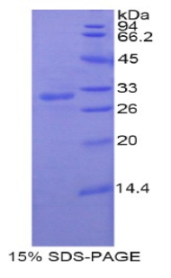PNMA2 / MA2 Protein - Recombinant Paraneoplastic Antigen MA2 By SDS-PAGE