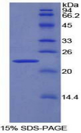 PNOC / Nociceptin Protein - Recombinant Pronociceptin By SDS-PAGE