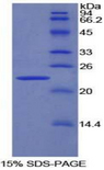 PNOC / Nociceptin Protein - Recombinant Pronociceptin By SDS-PAGE