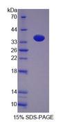 PNP / Nucleoside Phosphorylase Protein - Recombinant Nucleoside Phosphorylase (NP) by SDS-PAGE