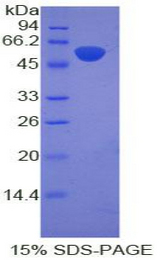 POMC / Proopiomelanocortin Protein - Recombinant Proopiomelanocortin By SDS-PAGE