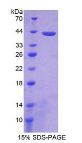 PPP2R4 Protein - Recombinant Protein Phosphatase 2A Activator, Regulatory Subunit 4 By SDS-PAGE