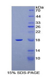 PR / Progesterone Receptor Protein - Recombinant Progesterone Receptor By SDS-PAGE