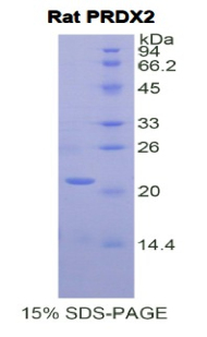 PRDX2 / Peroxiredoxin 2 Protein - Recombinant Peroxiredoxin 2 By SDS-PAGE