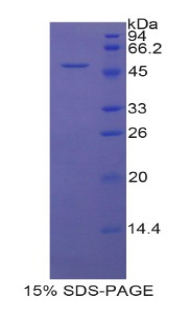 PRDX3 / Peroxiredoxin 3 Protein - Recombinant Peroxiredoxin 3 By SDS-PAGE