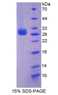PRF1 / Perforin Protein - Recombinant Perforin 1 By SDS-PAGE