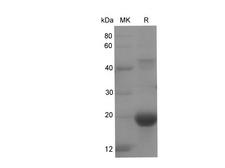 PRKAA2 / AMPK Alpha 2 Protein - Recombinant Rat AMPK alpha2 Protein (His Tag)-Elabscience