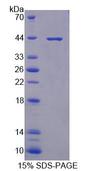 PRKX Protein - Recombinant Protein Kinase, X-Linked By SDS-PAGE