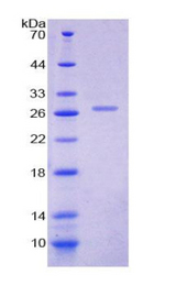 PRL / Prolactin Protein - Recombinant Prolactin By SDS-PAGE