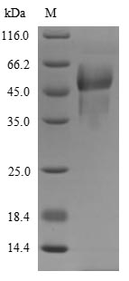 PROC / Protein C Protein - (Tris-Glycine gel) Discontinuous SDS-PAGE (reduced) with 5% enrichment gel and 15% separation gel.