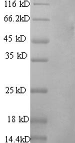 PROS1 / Protein S Protein - (Tris-Glycine gel) Discontinuous SDS-PAGE (reduced) with 5% enrichment gel and 15% separation gel.