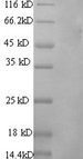 PROS1 / Protein S Protein - (Tris-Glycine gel) Discontinuous SDS-PAGE (reduced) with 5% enrichment gel and 15% separation gel.